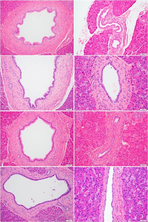 Figure 3. Liraglutide studies in nonhuman primates (hematoxylin and eosin staining). Top row: 52 weeks’ study control males. Second row: 87 weeks’ study control females. Third row: 52 weeks’ study high-dose males. Bottom row: 87 weeks’ study high-dose females. Left: Original magnification ×200; bar indicates 100 µm. Ductular part of the exocrine pancreas with presence of a large main duct with columnar epithelium. The duct is surrounded by connective tissue but is still located within the parenchyma. The duct from high-dose group looks similar to that of the control monkeys. Right: Original magnification ×400; bar indicates 50 µm. Exocrine acinar cell parenchyma and ductular part of the exocrine pancreas with presence of medium-sized interlobular ducts with cuboidal epithelium. The duct epithelium is lower and the amount of the surrounding connective tissue is lesser than for the large ducts. The duct from the high-dose group looks similar to that of the control monkeys. The acinar secretory compartment consists of pyramid-shaped cells where the apical part is filled with eosinophilic zymogen granules and the basophilic basal part contains the nucleus. The secretory compartment from high-dose group looks similar to that of the control monkeys.