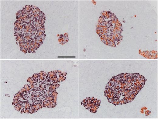Figure 4. Fifty-two weeks’ liraglutide study in nonhuman primates. Male (left) and female (right) from control (upper row) or liraglutide high-dose group (lower row). Double immunohistochemical staining for β-cells (reddish brown) and non–β-cells (the sum of glucagon, somatostatin, and PP, violet/black). Islet structure and distribution of β-, and non–β-cells from liraglutide-dosed animals look similar to what is seen in control animals. Original magnification ×400; bar indicates 100 µm.
