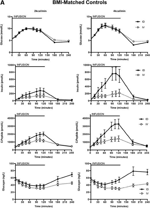 Figure 1. Blood glucose, plasma insulin, C-peptide, and glucagon concentrations at baseline and in response to a 120-min intraduodenal glucose infusion at 2 and 4 kcal/min and corresponding isoglycemic intravenous glucose infusions in (A) BMI-matched controls and (B) type 2 patients. Data are mean ± SEM. Filled circles with bold line, intraduodenal glucose infusion; empty circles with dotted line, isoglycemic intravenous infusion. ID, intraduodenal; IV, intravenous; T2DM, type 2 diabetes.