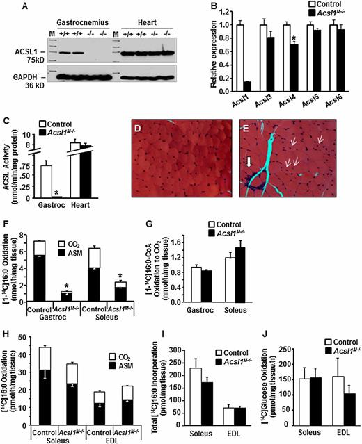 Figure 1. ACSL1 deficiency decreased ACSL-specific activity and FA oxidation in skeletal muscle. A: ACSL1 protein in the gastrocnemius muscle and heart in Acsl1M−/− and control mice. B: mRNA expression of Acsl1 isoforms in gastrocnemius relative to tubulin (males; n = 8). C: ACSL-specific activity in homogenates from the gastrocnemius muscle and heart (n = 4). Histology (×20) of control (D) and Acsl1M−/− (E) gastrocnemius. Thin arrows, central nuclei; thick arrow, macrophage infiltration. FA oxidation in homogenates from gastrocnemius and soleus muscle from [1-14C]palmitate (F) or [14C]palmitoyl-CoA (G) (n = 3–4). Oxidation (H) or incorporation (I) in isolated soleus or extensor digitorum longus with [14C]16:0, or with [14C]glucose (J) (n = 5). *P < 0.05, compared with control littermates. EDL, extensor digitorum longus; Gastroc, gastrocnemius.