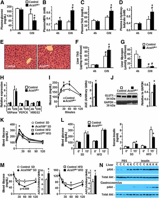 Figure 2. Acsl1M−/− mice were more vulnerable to hypoglycemia and hepatic lipid accumulation after an overnight fast and required less insulin to maintain euglycemia. Plasma glucose (A), nonesterified FAs (NEFAs) (B), TAG (C), and β-hydroxybutyrate (D) in female Acsl1M−/− after food removal for 4 h (n = 9–11) or fasting overnight (O/N) (n = 7–17). E: Histology of representative liver slides from female control and Acsl1M−/− mice after an overnight fast (hematoxylin-eosin staining). Measurement after an overnight fast of liver TAG (F) and glycogen (G) content (n = 4–8). H: Gene expression of glucose-6-phosphatase (G6Pase), phosphoenolpyruvate (PEPCK), and hydroxymethylglutaryl-CoA synthase-2 (HMGS2) in male mice (n = 6–10). I: Glycerol tolerance test in male mice after an overnight fast (n = 4). J: GLUT1 protein in gastrocnemius muscle (n = 4–5). In control and Acsl1M−/− female mice fed a high-fat diet (HFD) or matched standard diet (SD): glucose tolerance (K); blood glucose and insulin levels before and 15 min after intraperitoneal administration of insulin (L); and insulin tolerance tests and areas above the curve (AAC) after food removal for 4 h (M). N: pAkt (T308) and total Akt in female liver and gastrocnemius muscle 10 min after intraperitoneal PBS or insulin. C, control mice; K, knockout mice. #P < 0.05, vs. 4-h state (same genotype); *P < 0.05, vs. control (same treatment).