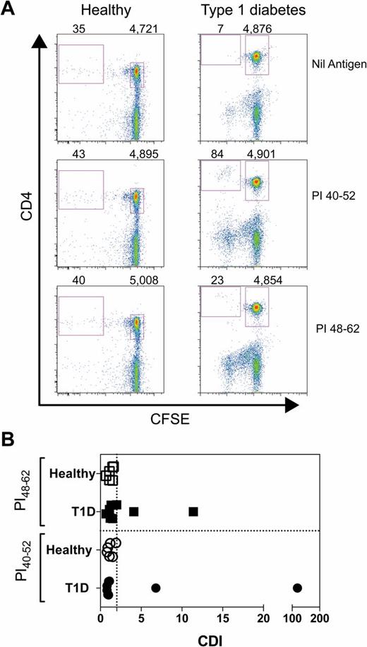 Figure 4. CD4+ T-cell responses to proinsulin peptides in peripheral blood mononuclear cells. A: Two groups were tested: PBMCs from individuals without T1D (“healthy”) and PBMCs from donors with recent-onset (<3 months) T1D (“type 1 diabetes”). A CFSE-based proliferation assay was used to detect proinsulin-specific CD4+ T-cell responses. Flow cytometry was performed using a BD LSRFortessa. A representative plot, gated on viable (propidium iodide negative) lymphocytes stained with Alexa Fluor 647 anti-CD4 (clone OKT4; conjugate in house) and CFSE, is shown. Two gates are shown in each plot. The upper right-hand gate includes CD4+ CFSEbright cells that did not proliferate. The number of events in this gate is shown above the plot. The second gate included the CD4+, CFSEdim cells that did proliferate. The number of events in this gate is shown above the plot. CD4+ T-cell proliferation is quantified by standardizing the number of CD4+, CFSEdim events for each sample to 5,000 CD4+, CFSEbright events (29). The standardized number of CD4+ CFSEdim events is expressed as a ratio, known as the CDI of the number of events with antigen (proinsulin [PI] 40–52 or proinsulin 48–62) to the number of events without antigen (“nil antigen”). Each antigen, including nil, was tested in triplicate. B: A summary of responses to proinsulin peptides. The mean (of triplicate) CDI for responses to proinsulin 40–52 and proinsulin 48–62 (both peptides were tested at 10 μM) for eight HLA-DQ8+ subjects with recent-onset (<3 months) T1D and six HLA-DQ8+ subjects who do not have T1D are shown. The differences between responses from donors with and without T1D did not reach statistical significance (P > 0.05, unpaired t test with Welch’s correction). The dotted vertical line is a CDI of 2.0, which is the cutoff between positive and negative responses. All subjects’ CD4+ T cells responded to tetanus toxoid in these assays.