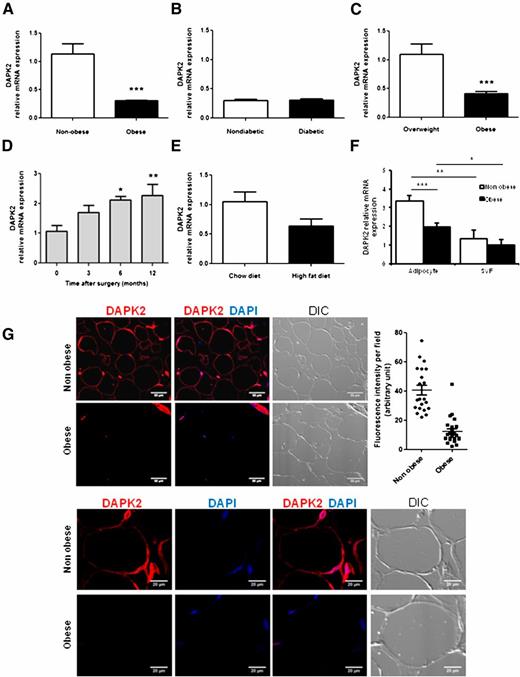 Figure 1. Downregulation of adipocyte DAPK2 expression in obesity. A: DAPK2 mRNA (relative to 18S) was quantified by RT-PCR in subcutaneous adipose tissue of 10 nonobese healthy subjects (mean BMI 23 kg/m2) and 65 massively obese patients (BMI range 34–79 kg/m2). B: Stratification of the obese group for diabetes (33 subjects among 65). C: DAPK2 mRNA in a subgroup of subjects with overweight (n = 10, BMI range 25–28 kg/m2) or with massive obesity (n = 24). D: Time course of DAPK2 mRNA recovery after obesity treatment by gastric bypass surgery. Nine patients undergoing surgery were followed up over time, and adipose tissue specimens were collected. Significant changes before vs. after surgery were assessed by the Wilcoxon signed rank test. E: DAPK2 mRNA expression in inguinal adipose tissue of mice fed a control chow diet or high-fat diet for 16 weeks. Bars are mean ± SEM values from five individual mice. F: Floating adipocyte fraction was separated from the SVF by collagenase digestion of adipose tissue specimens obtained from 9 lean and 10 obese subjects. DAPK2 expression (relative to 18S) was determined in paired cell fractions by quantitative RT-PCR. Statistically significant differences between groups are indicated. ***P < 0.001; **P < 0.01; *P < 0.05. G: DAPK2 immunolabeling of subcutaneous adipose tissue sections. DAPK2 fluorescence intensity was quantified using ImageJ software, and background values obtained by omitting primary antibody were subtracted. A total of 50 adipose tissue fields from three lean and three obese donors were quantified. DIC, differential interference contrast.