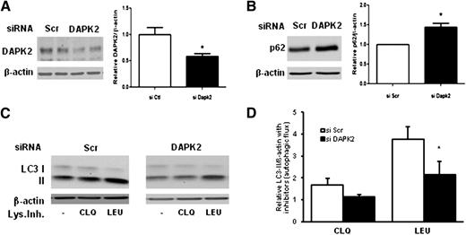 Figure 4. siRNA-mediated DAPK2 inhibition reduces autophagic flux. Effect of DAPK2 inhibition by siRNA on endogenous DAPK2 (A) and p62 (B) content. Control cells were transfected with scrambled (Scr) siRNA. C: Cells were incubated in complete serum-supplemented medium for 2 h in the presence or absence of lysosome inhibitors and lysed for Western blot analysis. D: Bars represent quantification of LC3-II accumulation with lysosome inhibitors (Lys.Inh.) (autophagic flux) as mean values ± SEM of three independent experiments with different cell donors in which LC3-II/actin signals with no inhibitor were arbitrarily set to 1. CLQ, chloroquine; Ctl, control; LEU, leupeptin/NH4Cl. *P < 0.05 indicating statistical significance.