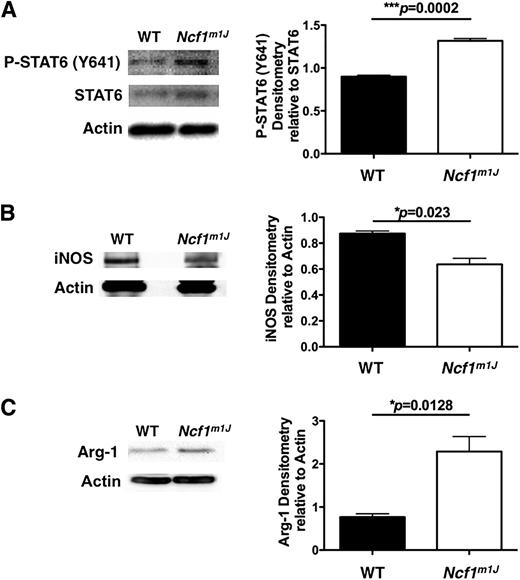 Figure 4. NOD.Ncf1m1J islets exhibit lowered M1 and elevated M2 levels of macrophage markers. Purified islet whole-cell lysates from prediabetic 16-week-old NOD and NOD.Ncf1m1J mice were used in an immunoblot analysis for P-STAT6 (Y641) and STAT6 (A), iNOS (B), and Arg-1 (C). Densitometry statistics for Western blotting represent the average of three experiments. ***P < 0.001; *P < 0.05. WT, wild type.