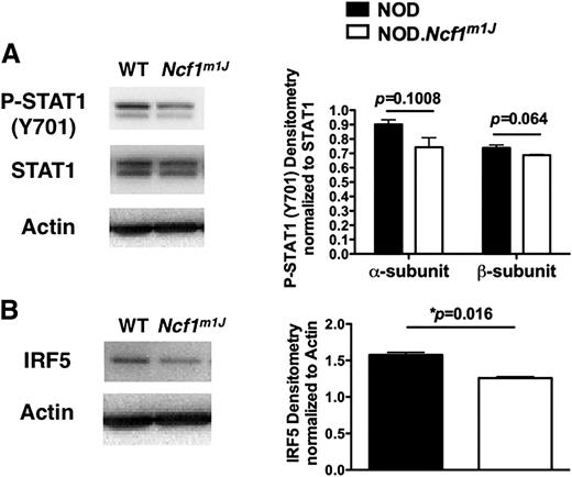 Figure 8. Polarized NOD.Ncf1m1J BM-Mϕs exhibit reduced levels of P-STAT1 (Y701) and IRF5. NOD and NOD.Ncf1m1J BM-Mϕs were incubated for 180 min under M1 polarization conditions. Whole-cell lysates were extracted and probed for P-STAT1 (Y701) (A), STAT1 (A), IRF5 (B), and actin (A, B). Densitometry statistics for Western blotting represent the average of two experiments. WT, wild type. *P < 0.05.