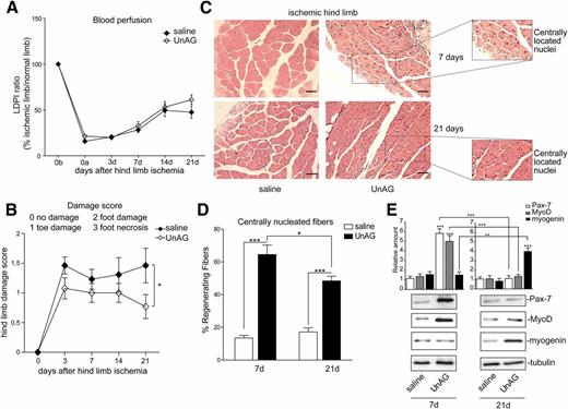Figure 1. UnAG protects ob/ob mice against ischemia-induced functional impairment. A: Histogram representation of blood perfusion reported as ratio (mean ± SEM, n = 13 for each group) of ischemic to normal hind limb for both groups of mice (0b, before surgery; 0a, after surgery). B: Foot damage score was evaluated for the indicated times. Data are expressed as mean ± SEM; n = 13. *P < 0.05 UnAG vs. saline in ischemic limb. C: Representative hematoxylin and eosin–stained sections of ischemic muscles from saline- and UnAG-treated mice, at days 7 and 21 postsurgery. Scale bars, 80 μm (×20 magnification). Insets show regenerating myofibers at higher magnification. D: Quantification of the percentage (mean ± SEM) of regenerating fibers, characterized by the presence of a centrally located nucleus. UnAG- and saline-treated mice were analyzed at days 7 and 21 postsurgery. *P < 0.05 UnAG-treated mice at day 7 vs. day 21; ***P < 0.001 ischemic muscles of UnAG- vs. saline-treated mice at days 7 and 21. E: Cell extracts from SCs recovered from ischemic muscles at days 7 and 21 were analyzed by Western blot for Pax-7, MyoD, and myogenin content and normalized to tubulin content. **P < 0.01 myogenin from UnAG-treated mice at day 7 vs. day 21; ***P < 0.001 Pax-7 and MyoD content in ischemic SCs from UnAG- vs. saline-treated mice at day 7; ***P < 0.001 myogenin content in ischemic SCs from UnAG- vs. saline-treated mice at day 21; ***P < 0.001 Pax-7 and MyoD from UnAG-treated mice at day 7 vs. day 21. A–D: n = 13 each group at days 7 and 21. E: n = 3 each group at days 7 and 21. LDPI, laser Doppler perfusion imaging.