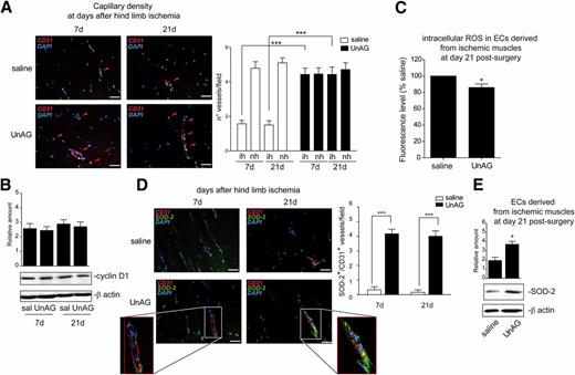 Figure 2. UnAG protects the intramuscle vessels of ob/ob mice subjected to hind limb ischemia and increases SOD-2 expression. A: Sections of ischemic muscles recovered from saline- and UnAG-treated mice at days 7 and 21 postsurgery were stained for CD31 (red) and DAPI (blue). Red arrows indicate vessels. Scale bars, 40 μm (×40 magnification). The graph on the right represents the number of vessels in ischemic (ih) and normoperfused (nh) gastrocnemius muscles as evaluated by three different operators counting 10 fields at ×40 magnification and reported as mean ± SEM (n = 7 each group at days 7 and 21) of vessels per field. ***P < 0.001 ih muscles of UnAG mice vs. ih muscles of saline mice at days 7 and 21. B: Cell extracts of ECs recovered from ischemic muscles of treated mice at days 7 and 21 were analyzed for cyclin D1 content by Western blot and normalized to β-actin content. The results are representative of three different experiments. C: Intracellular ROS generation was analyzed using a Amplex Red fluorescence assay kit on ECs recovered from muscles of treated mice by cell-magnetic sorting at day 21 after ischemia. The fluorescence level (mean ± SEM, n = 3 each group) is reported as fold induction relative to “saline” values, which were arbitrarily set as 100. *P < 0.05 UnAG- vs. saline-treated mice. D: Representative stained sections for CD31 (red), SOD-2 (green), and DAPI (blue) of muscles recovered at days 7 and 21 postsurgery. Insets show SOD-2 and CD31 colocalization at higher magnification. Scale bars, 40 μm (×40 magnification). Quantification of SOD-2+/CD31+ cells per field (×40 magnification) in ischemic vessels of treated mice is reported in the graph at right (mean ± SEM, n = 7 each group). ***P < 0.001 UnAG- vs. saline-treated mice at days 7 and 21. E: Cell extracts of ECs recovered from ischemic muscles of treated mice at day 21 were analyzed for SOD-2 content by Western blot and normalized to β-actin content. The results are representative of three different experiments. *P < 0.05 ECs from UnAG- vs. saline-treated mice.