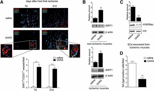 Figure 3. UnAG increases SIRT1 levels in ischemic vessels and protects ECs from senescence. A: Representative stained sections for CD31 (red), SIRT1 (green), and DAPI (blue) of muscles recovered at days 7 and 21 after ischemia. Insets show SIRT1 and CD31 colocalization at higher magnification. Scale bar, 40 μm (×40 magnification). Quantification of SIRT1+/CD31+ cells per field (×40 magnification) in ischemic vessels of treated mice is reported in the graph (mean ± SEM, n = 7 each group) (***P < 0.001 UnAG- vs. saline-treated mice at days 7 and 21). B: ECs recovered from nonischemic or ischemic muscles as described in research design and methods were subjected to Western blot analysis for SIRT1 content. Protein levels were normalized to β-actin content. **P < 0.01 UnAG- vs. saline-treated mice for nonischemic ECs (top); **P < 0.01 UnAG- vs. saline-treated mice for ischemic ECs (bottom); n = 3. C: Cell extracts from ECs recovered from the ischemic muscles of treated mice were analyzed for H3K56ac content, which was normalized to H3 content. **P < 0.01 UnAG vs. saline; n = 3. D: Senescence was evaluated on ECs recovered from ischemic muscles at day 21 and expressed as the mean ± SEM of SA–β-gal–positive cells per field. **P < 0.01 UnAG vs. saline; n = 3. H3K56ac, H3K56 acetylation.