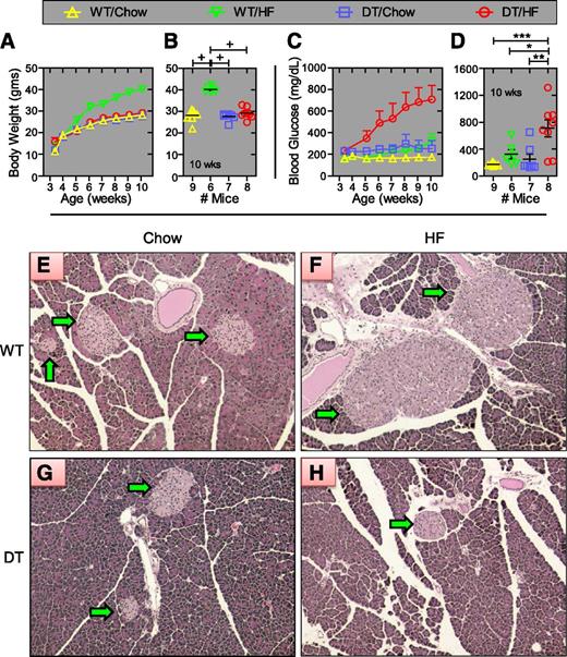 Figure 1. DT mice fed an HF diet develop severe diabetes. Male DT and WT NONcNZO10/Ltj littermates (N5) were fed chow or HF food beginning at 3 weeks of age. Group average body weights and blood glucose levels at the indicated week are shown in panels A and C. Values for individual mice at 10 weeks of age are shown in panels B and D. Values are ± SEM. *P < 0.05, **P = 0.01, ***P = 0.001, and +P = 0.0001, determined by one-way ANOVA using Bonferroni correction for multiple comparisons. At 10 weeks of age, pancreata from WT (panels E and F) and DT (panels G and H) mice fed chow (panels E and G) and the HF diet (panels F and H) were removed, fixed, embedded in paraffin, sectioned, and stained with hematoxylin and eosin. The green arrows point to islets. Photos are representative images and identically cropped and sized. Sections from at least four mice were examined for each group.