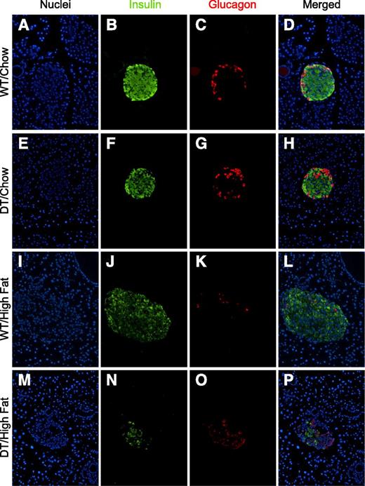 Figure 2. HF feeding reduces β-cell mass in DT mice. Pancreas sections from 10-week-old WT and DT littermates (N5) fed the indicated diet were stained with antibodies to insulin plus glucagon. Images were photographed to show only nuclei (blue) (panels A, E, I, and M), insulin (green) (panels B, F, J, and N), and glucagon (red) (panels C, G, K, and O). Images merged in Photoshop are shown in panels D, H, L, and P. WT mice are shown in panels A–D and I–L. DT mice are shown in panels E–H and M–P. Sections from representative mice fed standard chow or HF food are shown in panels A–H and I–P, respectively. Sections were prepared from mice shown in Fig. 1, and at least four mice were examined for each group. All images were identically cropped and sized.