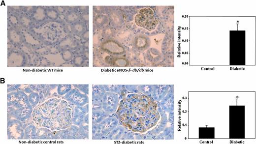 Figure 1. Detection of renal halogenated proteins in experimental diabetes. Renal sections from C57BLKS and eNOS−/− C57BLKS db/db mice (A) and from Sprague-Dawley control and STZ-induced diabetic rats (B) were analyzed using monoclonal antibody, which recognizes HOCl- and HOBr-modified proteins, as described in research design and methods. *P < 0.01, mouse/rat diabetic vs. control (n = 5). WT, wild type.