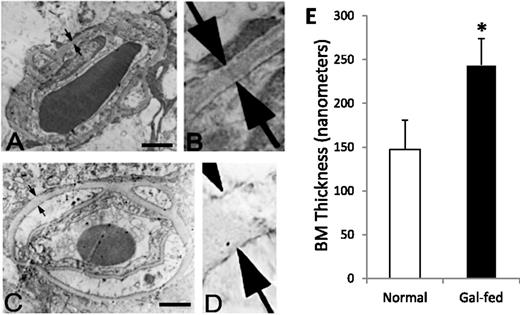 Figure 2. Capillary BM thickness in retinas of marmoset. BM thickness (arrows) in transverse sections of a retinal capillary from normal marmoset (A). B: Corresponding enlarged view. C: Gal-fed marmoset. D: Corresponding enlarged view. Magnification bar: 1 μmol/L. E: Graphical illustration of capillary BM thickness in retinas of normal and gal-fed marmoset. *P < 0.02.