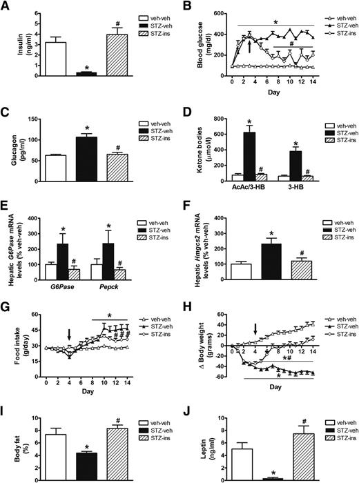 Figure 5. Insulin treatment normalizes diabetic hyperglycemia, hyperglucagonemia, and ketosis characteristic of uDM. Plasma insulin (A), fed blood glucose (B), plasma glucagon (C), and ketone body levels (AcAc and 3-HB and 3-HB alone) (D) and hepatic expression of the gluconeogenic genes phosphoenolpyruvate carboxykinase (Pepck) and glucose-6-phosphatase (G6Pase) (E) and the ketogenic gene mitochondrial HMG-CoA synthase (Hmgcs2) (F) using real-time PCR, food intake (G), body weight change (H), percent body fat (I), and plasma leptin levels (J) in nondiabetic controls (veh-veh) or in STZ-induced diabetic animals that were implanted either with an insulin pellet (STZ-ins; 2 units/day) or placebo (STZ-veh) (n = 6–7 per group). Data represent mean ± SEM. *P < 0.05 vs. veh-veh; #P < 0.05 vs. STZ-veh.