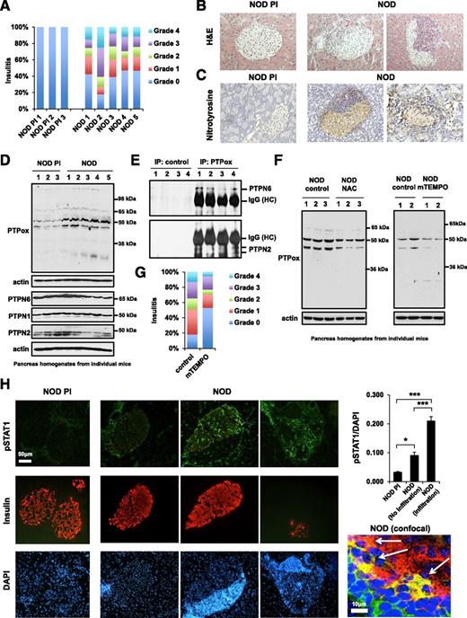 Figure 1. Oxidative stress and pancreatic PTP oxidation in NOD mice with prediabetes. A: Insulitis development was scored on pancreata collected from female NOD PI and NOD mice at 12 weeks of age. Serial sections (3 μm thick) were prepared at three levels (200 µm apart) and scored in a blinded manner using the following scale: 0 = no infiltrate, 1 = peri-islet infiltrate, 2 = extensive (>50%) peri-islet infiltrate, 3 = intraislet infiltrate, and 4 = extensive intraislet infiltrate (>80%) or total β-cell loss. Greater than 50 islets per pancreas were scored. The percentage of islets per pancreas with each score was calculated. Scores were added to give an overall score for each pancreas, and data are shown as the mean. B: Paraffin sections (3 μm) of pancreas from 12-week-old NOD PI and NOD mice stained with hematoxylin and eosin (H&E). C: Paraffin sections were immunolabeled with the oxidative stress marker nitrotyrosine and counterstained with hematoxylin. D: Immunoblot analysis with PTPox antibody to determine relative PTP oxidation (PTP-SO3H) or for the indicated PTPs in 12-week-old NOD PI vs. NOD pancreas samples. E: Immunoprecipitation (IP) of PTPox proteins from NOD pancreas samples and immunoblotting for PTPN6 (67 kDa) or PTPN2 (45/48 kDa). IgG heavy chain (HC) band (50 kDa) is shown. F: Female NOD mice (6 weeks old) were treated with NAC (1 mg/mL; Sigma-Aldrich, St. Louis, MO) for 8 weeks or mTEMPO (1 mmol/L; Enzo Life Sciences, Farmingdale, NY) for 14 weeks in drinking water and pancreata extracted for an assessment of PTP oxidation by SDS-PAGE. G: Insulitis scores on pancreata collected from female NOD mice that were treated with the control or with mTEMPO for 20 weeks (n = 8 per group). H: Cryosections of pancreata from 12-week-old NOD PI or NOD mice stained with antibodies recognizing pSTAT1, insulin, and DAPI (bar = 50 µm). Quantification of pSTAT1 staining after correction for nuclear DAPI in islets is shown. A total of 25 islets from 4 NOD PI mice, 7 islets without infiltration, and 124 islets with infiltration from 6 NOD mice were scored. *P < 0.05, ***P < 0.001. Confocal image of overlapped staining (green: pSTAT1, red: insulin, blue: DAPI) demonstrates pSTAT1/insulin costaining (white arrows). Scale bar is 10 µm.