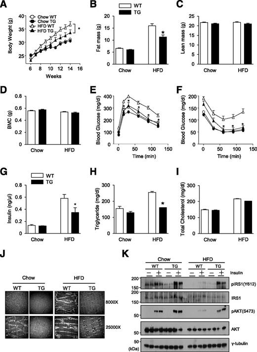Figure 5. Muscle-specific SENP2 overexpression alleviates HFD-induced obesity and insulin resistance. A: WT and mSENP2-TG (TG) mice at 8 weeks were fed with a standard chow diet or HFD, consisting of 60% fat and 6.8% sucrose, for the next 12 weeks. Their body weights were measured every day for 14 weeks (n = 15–20/group). Data are the mean ± SEM. *P < 0.05. B–D: Body fat mass (B), lean mass (C), and bone mineral contents (BMC) (D) were measured after feeding the mice with chow or HFD for 10 weeks using DXA scanning. *P < 0.05. E and F: Glucose tolerance test (E) and insulin tolerance test (F) were performed. *P < 0.05. G–I: The levels of insulin (G), triglycerides (H), and total cholesterol (I) in serum were measured. *P < 0.05. Note that the P values were in comparison with WT mice fed with HFD (B and E–H). J: Sections of gastrocnemius muscle tissues were obtained and then subjected to electron microscopy. K: Mice were treated with insulin for 20 min before sacrifice. Extracts prepared from the gastrocnemius muscle were subjected to immunoblot with respective antibodies.