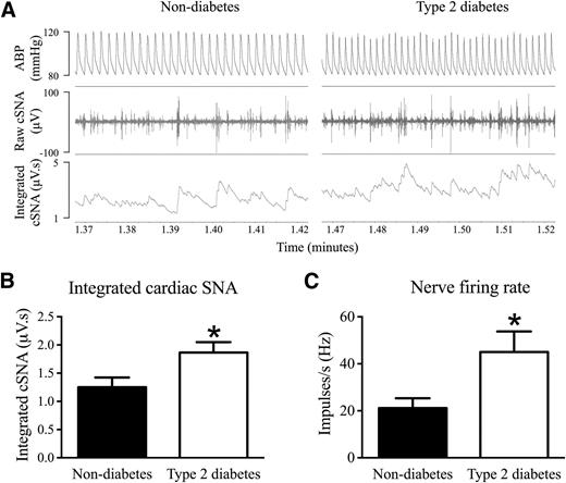 Figure 1. Direct in vivo recordings of cardiac SNA (cSNA): increased sympathetic input to the heart in type 2 diabetic ZDF rats. A: Representative LabChart recordings showing ABP, raw efferent cardiac SNA, and the derived integrated cardiac SNA in nondiabetic and type 2 diabetic ZDF rats. B: Increased integrated resting cardiac SNA. C: A trend toward an increased nerve firing rate in type 2 diabetic ZDF rats. *P < 0.05, significantly different from nondiabetic rats, unpaired t test, n = 11 per group. Data are presented as the mean ± SEM.