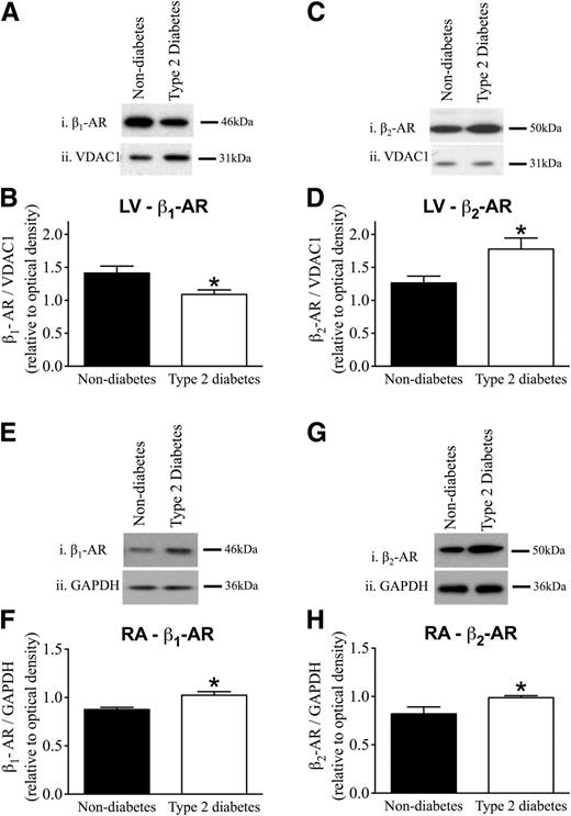 Figure 6. LV and RA β1-AR and β2-AR protein expression levels in type 2 diabetic ZDF rats. A, C, E, and G: Representative images of β1-AR and β2-AR Western blots in the left ventricle and right atrium. B, D, F, and H: Quantitative analysis of the protein expression (mean ± SEM; 3 replications). Shown are reduced β1-AR protein expression levels in the left ventricle (A and B) and increased β1-AR levels in the right atrium (E and F) in the type 2 diabetic group relative to the nondiabetic group, normalized to VDAC or GAPDH protein expression levels. *P < 0.05 vs. nondiabetes, unpaired t test. LV: nondiabetes n = 17; type 2 diabetes n = 20; RA: nondiabetes n = 7; type 2 diabetes n = 6 (mean ± SEM; 3 replications). The β2-AR protein expression levels were elevated in the left ventricle (C and D) and in the right atrium (G and H) in the type 2 diabetic group relative to the nondiabetic group, normalized to VDAC or GAPDH protein expression levels. *P < 0.05 vs. nondiabetes, unpaired t test. LV: nondiabetes n = 17; type 2 diabetes n = 17; RA: nondiabetes n = 7; type 2 diabetes n = 6 (mean ± SEM; 3 replications).