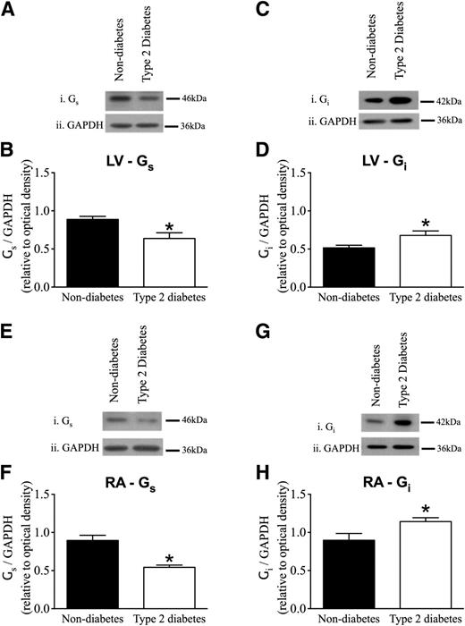Figure 7. LV and RA Gs and Gi expression levels in type 2 diabetic ZDF rats. A, C, E, and G: Representative images of Gs and Gi Western blots in the left ventricle and right atrium. B, D, F, and H: Quantitative analysis of the protein expression. Shown are reduced Gs expression levels in the left ventricle (A and B) and right atrium (E and F) in the type 2 diabetic group relative to the nondiabetic group, normalized to GAPDH protein expression levels. Gi expression levels are elevated in the left ventricle (C and D) and right atrium (G and H) in the type 2 diabetic group relative to the nondiabetic group, normalized to GAPDH protein expression levels. *P < 0.05 vs. nondiabetes, unpaired t test. Nondiabetes n = 7; type 2 diabetes n = 6 (mean ± SEM; 3 replications, except for LV Gs duplicates).