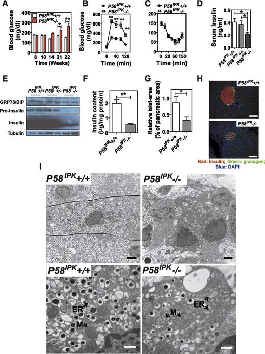Figure 1. Deletion of P58IPK in mice causes β-cell failure. A: Blood glucose was measured in P58IPK+/+ and P58IPK−/− mice at the indicated age after a 5-h fast (n = 5 or 6 mice per group). B: A GTT was performed (n = 5 or 6 mice [6–7 weeks of age] per group). C: An insulin tolerance test was performed (n = 5 or 6 mice [9–10 weeks of age] per group). D: Serum insulin after a 5-h fast was measured in 16- to 20-week-old mice after a 5-h fast. E: Western blot analysis was performed using 100 islets isolated from 10-week-old mice. F: Pancreatic insulin content was measured and normalized to protein content (n = 5 mice [10–12 weeks of age] per group). G: Islet mass was measured in pancreatic sections from 16- to 20-week-old mice. The percentage indicates the total islet mass over the pancreas area in each pancreata (n = 3 mice per group). H: Immunohistochemistry for insulin and glucagon was performed on pancreatic sections from 10- to 12-week-old mice. Representative images are shown. Scale bar represents 100 μm. I: Transmission electron microscopy was performed on pancreatic sections from 12-week-old mice. Representative images are shown. Scale bar represents 2 μm in upper panels and 0.5 μm in lower panels. ER, rough endoplasmic reticulum; M, mitochondria. *P < 0.05; **P < 0.01.