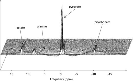 Figure 3. An example of in vivo spectral time course taken from a control Wistar rat heart showing the injection and subsequent decay of the hyperpolarized [1-13C]pyruvate due to recovery back to thermal equilibrium, and exchange with [1-13C]lactate, [1-13C]alanine, and [13C]bicarbonate.