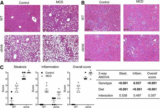 Figure 1. Liver and kidney histology in WT and ob/ob mice. Hematoxylin-eosin–stained liver (A) and kidney (B) sections from WT or ob/ob mice fed either a control or MCD diet. Original magnification ×200. C: Pathology scores were as follows: 0, no significant lesions (0%); 1, minimal (<10%); 2, mild (10–25%); 3, moderate (25–40%); 4, marked (40–50%); and 5, severe (>50%). Data represent mean ± SEM. Boldface values in the table indicate P < 0.05. Control, n = 5; MCD, n = 4; ob/control, n = 5; ob/MCD, n = 5. *P value < 0.05 according to a two-way ANOVA Bonferroni posttest that was performed comparing control to MCD or ob/control to ob/MCD. Closed circles, control diet; open triangles, MCD diet.