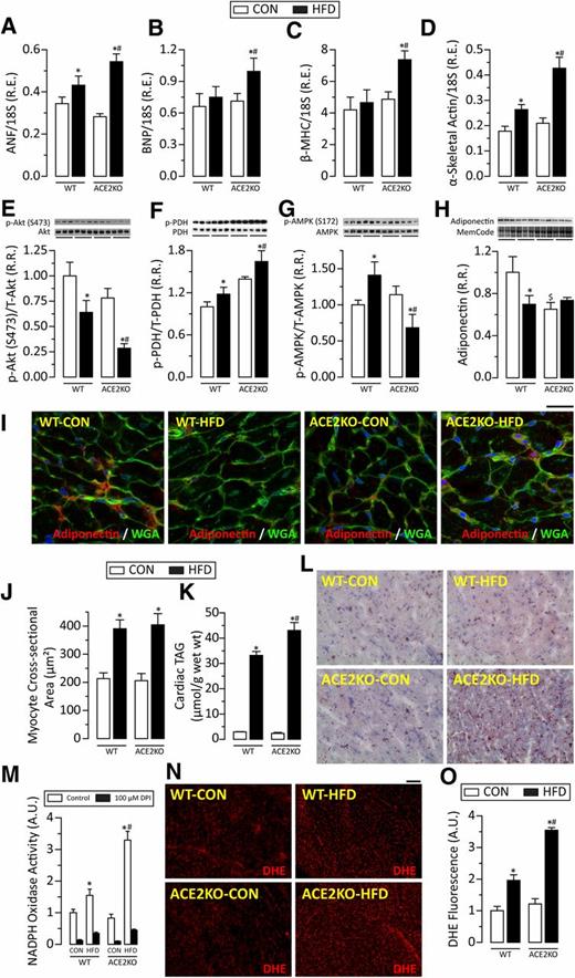 Figure 3. Loss of ACE2 results in cardiac steatosis, oxidative stress, and modulation of molecular signaling pathways in response to DIO. Increased mRNA expression of ANF (A), BNP (B), β-MHC (C), and α-skeletal actin (D) shows heart failure progression in ACE2KO-HFD hearts in response to DIO. Western blot analysis shows a greater decrease in phosphorylation of Akt in ACE2KO-HFD hearts compared with WT-HFD hearts (E). Phosphorylation of PDH was increased in WT-HFD hearts and further increased in ACE2KO-HFD hearts (F). Phosphorylation of AMPK was increased in WT-HFD hearts but decreased in ACE2KO-HFD hearts (G). Western blot analysis (H) and representative IF images (I) show decreased adiponectin levels in WT-HFD hearts. ACE2KO-CON hearts showed reduced basal levels of myocardial adiponectin, which remained low in response to DIO. Representative WGA-stained images (I) and myocyte cross-sectional area (J) show equivalent cardiac hypertrophy in WT-HFD and ACE2KO-HFD mice. Biochemical analysis showed increased cardiac TAG levels (K), and Oil Red O staining showed increased intramyocardial lipid accumulation (L) in ACE2KO hearts in response to DIO. NADPH oxidase activity (M), representative DHE staining images (N), and quantification of DHE fluorescence (O) show increased oxidative stress in ACE2KO-HFD hearts compared with WT-HFD hearts. n = 12 (A–D); n = 6 (E–H); n = 4 (I, J, L, N, O); n = 10 (K, M). *P < 0.05 compared with the respective CON groups; #P < 0.05 compared with the WT-HFD group; $P < 0.05 compared with WT-CON group. Scale bar = 25 μm (I) and 100 μm (N). A.U., arbitrary unit; p, phosphorylated; R.E., relative expression; R.R., relative ratio; T, total; wt, weight.