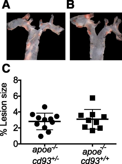 Figure 1. Representative image of the descending aorta stained with Sudan IV from apoe−/−cd93+/− mice (A) and apoe−/−cd93+/+ mice (B). C: Quantification of lesions in the descending aorta of female and male apoe−/−cd93+/− (black dots, n = 11 [6 male, 5 female]) or apoe−/−cd93+/+ (black squares, n = 9 [5 male, 4 female]) mice.