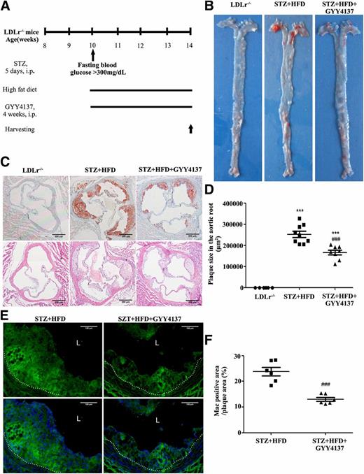 Figure 1. Effects of H2S on atherosclerosis in HFD-fed diabetic LDLr−/− mice. Diabetic LDLr−/− mice were fed an HFD and received daily intraperitoneal injection of saline or H2S donor GYY4137 (133 μmol/kg/day) for 4 weeks. A: Schema of experimental procedure. B: Lesion areas shown were quantified using ORO staining of the thoracoabdominal aorta. C and D: Representative ORO- and H-E–stained images and quantification of aortic sinus sections from LDLr−/− (n = 6), STZ+HFD (n = 9), and STZ+HFD+GYY4137 (n = 8) mice. Scale bars, 200 μm. E and F: Frozen sections of aortic root were stained for antimacrophage (green) and DAPI (blue). Dotted lines indicate the boundary of lesion and aortic tunica intima. Quantitative data in the graph represent the positively stained area percentage of plaque (n = 6). Scale bars, 100 μm. Data shown are mean ± SEM. ***P < 0.001 vs. LDLr−/− mice; ###P < 0.001 vs. STZ+HFD mice. L, lumen.