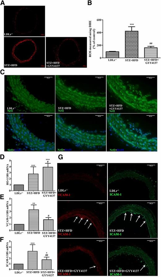 Figure 2. Effects of H2S on ROS formation and Nrf2, VCAM-1, and ICAM-1 expression in aortas from HFD-fed diabetic LDLr−/− mice. A: Representative DHE fluorescence image of aortic tissue from LDLr−/−, STZ+HFD, and STZ+HFD+GYY4137 mice. Scale bars, 100 μm. B: Quantification of DHE fluorescence image of A. ***P < 0.001 vs. LDLr−/− mice; ##P < 0.01 vs. STZ+HFD mice. n = 6. C: Representative immunostaining for Nrf2 (green) and DAPI (blue) of aorta. Scale bars, 50 μm. D: mRNA levels of HO-1 in the aortas of LDLr−/− (n = 6), STZ+HFD (n = 6), and STZ+HFD+GYY4137 (n = 8) mice, as determined by quantitative RT-PCR analysis. mRNA levels of VCAM-1 (E) and ICAM-1 (F) in the aortas of LDLr−/− (n = 6), STZ+HFD (n = 6), and STZ+HFD+GYY4137 (n = 6) mice. G: Representative VCAM-1 and ICAM-1 immunostaining of aortic arch section (with arrows). Scale bars, 100 μm. *P < 0.05, **P < 0.01, and ***P < 0.001 vs. LDLr−/− mice; #P < 0.05 and ##P < 0.01 vs. STZ+HFD mice.