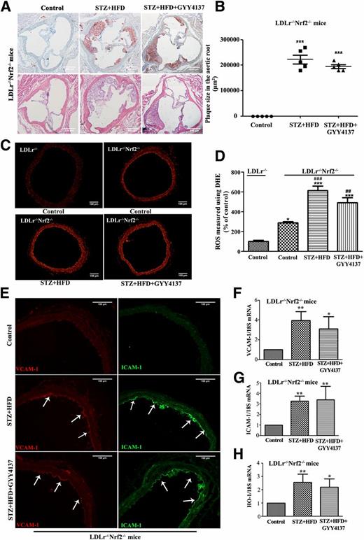 Figure 3. Effects of H2S on diabetes-accelerated atherosclerosis in LDLr−/−Nrf2−/− mice. Diabetic LDLr−/−Nrf2−/− mice were fed an HFD and received daily intraperitoneal injection of saline or GYY4137 (133 μmol/kg/day) for 4 weeks. A and B: Representative ORO- and H-E–stained images and quantification of aortic sinus sections from LDLr−/−Nrf2−/−, STZ+HFD, and STZ+HFD+GYY4137 mice (n = 5). Scale bars, 200 μm. C: Representative DHE fluorescence image of aorta. Scale bars, 100 μm. D: Quantification of DHE fluorescence image of C. *P < 0.05 and ***P < 0.001 vs. LDLr−/− mice; ##P < 0.01 and ###P < 0.001 vs. LDLr−/−Nrf2−/− mice. n = 5–7. E: Representative VCAM-1 and ICAM-1 immunostaining of aortic arch section (with arrows). Scale bars, 100 μm. mRNA levels of VCAM-1 (F) and ICAM-1 (G) in the aorta of LDLr−/−Nrf2−/−, STZ+HFD, and STZ+HFD+GYY4137 mice (n = 5). H: mRNA levels of HO-1 in the aorta (n = 5). Data shown are mean ± SEM. *P < 0.05 and **P < 0.01 vs. control.