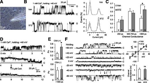 Figure 1. Effect of diabetes on ion channels in mouse brain mitochondria. A: Respective phase-contrast image of mitochondria patched with a micropipette. The scale bar is 10 μm. B: Representative single-channel current traces of a large conductance ion channel (∼1.0 ns) in brain mitochondria from nondiabetic controls and STZ-induced diabetic C57BL/6 WT mice. Mitochondria were clamped at +40 mV in the presence of 1 mmol/L Ca2+ in bath. All-point amplitude histograms for the traces are shown in the right panel. Amplitude distributions were fitted with two Gaussian components. C: Average opening probability (P0) of ion channels with various conductance in brain mitochondria with or without STZ-induced diabetes. The ratio of the area under the fitted “open” Gaussian to the total area under the entire Gaussian was taken as P0. D: Representative current trace of a large conductance ion channel with CsA-sensitive activity. Mitochondria were clamped at +40 mV, and 5 μmol/L CsA was added into the bath solution containing 1 mmol/L Ca2+ at 5 min. E: Average opening probability (P0) of large conductance ion channels with (upper panel) or without (lower panel) CsA sensitivity in vehicle or STZ-injected mice. F: CsA-sensitivity channels showed no difference in the channel conductance between the vehicle and STZ mitochondria. Representative single-channel current traces of the CsA-sensitive channel holding at the indicated voltages (from −60 to +60 mV with 20 mV intervals) are shown in the left panel. Current-voltage (I-V) plot was averaged from the CsA-sensitive channel recordings. Channel conductance was obtained from the I-V relationship. The “o” and “c” indicate open and closed states, respectively. Data are represented as mean ± SEM (n = 6–10 mice per group). Veh, vehicle. ns, not significant; *P < 0.05.