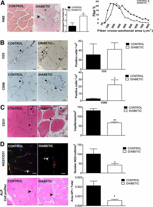 Figure 1. In situ characterization of MPs. A: Representative microphotographs of hematoxylin-eosin (H&E)–stained sections of human muscles. The arrow indicates degenerated fibers, whereas the arrowhead points at a centralized nucleus. Fat deposition is indicated by the black star. Quantitative analysis is depicted in the bar graph. Fiber composition was compared between C-MPs and D-MPs, measuring the cross-sectional area (left panel). Scale bars, 20 µm. B: The presence of inflammatory cell infiltration was quantified by immunohistochemistry using anti-CD3 and CD68 antibodies to detect, respectively, lymphocytes and macrophages (arrowheads). Macrophage infiltration was significantly increased in D-MPs. *P < 0.05 vs. controls, n = 4. Scale bars, 20 µm. C: Capillaries in the sections are indicated by brown CD31+ staining (black arrowheads) used for the quantification expressed in the bar graph. Values are expressed as the mean ± SEM of three control subjects and nine subjects with diabetes; **P < 0.01 vs. controls. Scale bars, 20 μm. D: Within the muscle structure, pericytes, which encircle capillaries (CD31+ cells), were identified by NG2 expression (white arrowheads). Nuclei were counterstained with DAPI. Pericyte count is shown in the bar graph. *P < 0.05 vs. control. Scale bars, 20 μm. In addition, pericytes were identified by positivity for ALP using the Cell Profiler software. The number of ALP+ pericytes in muscles from patients with diabetes was significantly reduced with respect to control subjects. Black arrowheads indicate ALP-positive pericytes within the muscle section. Values expressed as the mean ± SEM on three different donors. *P < 0.05 vs. control subjects. Scale bars, 100 µm.