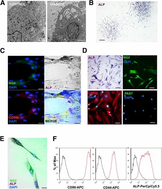 Figure 2. Characterization of isolated MPs. A: Transmission electron microscopy ultrastructure of MPs. Original magnification ×7,100. Scale bars, 20 µm. ALP immunostaining (B) and NG2 and CD146 immunofluorescence (C) of MPs after isolation from muscle biopsy samples. Positive cells were stained purple. Scale bars, 20 μm. D: MP expression of ALP, NG2, CD-146, and PAX7 to assess the antigenic characteristics of isolated cells. Nuclei were counterstained with DAPI. Scale bars, 50 μm. E: Double staining of MPs with ALP and anti-NG2. Scale bar, 10 μm. F: Flow cytometry analysis of MPs. Data are shown as peaks of positivity in reaction to staining (red line) for the markers CD90, CD44, and ALP vs. a negative control (dark line).