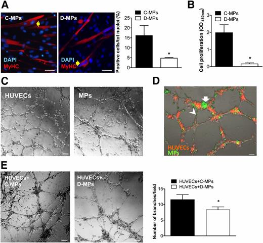 Figure 3. MP differentiation, proliferation, and network formation. A: Muscle differentiation: MPs were stained with anti-MyHC antibody to reveal syncytial myofiber-like structures (yellow arrowheads) generated by fusion. Nuclei were counterstained with DAPI. The bar graph summarizes the number of MyHC+ fibers counted on the total number of nuclei per field. Counts were made on five pictures from at least three biological replicates. Original magnification ×20. Scale bars, 50 μm. Values are expressed as the mean ± SEM. *P < 0.05 vs. C-MPs. B: Cell proliferation was measured as optical density (OD) after 48 h of culture, of which the last 24 h occurred in the presence of BrdU, as described in research design and methods. Values are expressed as the mean ± SEM of four experiments in triplicate. *P < 0.05 vs. C-MPs. C: Matrigel assay: compared with HUVECs (left panel), MPs (right panel) form networks that are less reticulated with thicker nodes and longer tubes. Scale bars, 100 µm. D: HUVEC-MP interaction on Matrigel. Fluorescent microphotograph of networks formed on Matrigel by coculturing HUVECs (stained red with PKH26 dye) and MPs (stained green with PKH67 dye) at ×5 magnification. MPs locate preferentially at nodes of the network (white arrow). They are also located along the tube assisting HUVECs in tubulization (white arrowhead). Scale bar, 100 μm. E: Direct interaction with ECs (HUVECs): microphotographs of networks formed by MPs in coculture with HUVECs at a 1:4 MP/HUVEC ratio. Bar graphs represent the efficiency of network formation in terms of the number of branches. Values are expressed as the mean ± SEM of at least five experiments in duplicate; *P < 0.05 vs. HUVECs+C-MPs. Scale bars, 100 μm.
