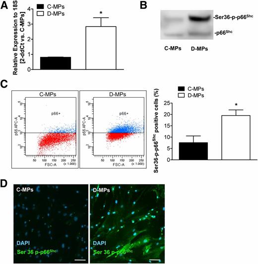 Figure 7. Induced p66Shc expression in D-MPs. A: Transcriptional analysis of the ROS sensor protein p66Shc. Values are expressed as the mean ± SEM of three experiments. *P < 0.05 C-MPs. B: Western blot: C-MPs (lane 1) and D-MPs (lane 2) were compared for the expression of both total p66Shc and serine phosphorylated (Ser36-p-p66Shc) isoforms using the anti-Ser36-p-p66Shc clone 6E10. C: Flow cytometry analysis and quantification of the percentage of Ser36-p-p66Shc+ cells are expressed as the mean ± SEM of three experiments. *P < 0.05 vs. C-MPs. D: Immunofluorescence microscopy analysis of phospho-p66Shc+ MPs. Scale bars, 50 μm.