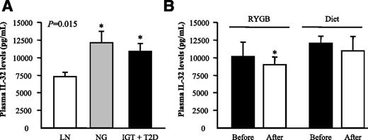 Figure 1. Circulating concentrations of IL-32 in obesity and obesity-associated T2D. Impact of weight loss. Fasting plasma concentrations of IL-32 determined by ELISA in LN volunteers (n = 16), OB NG subjects (n = 26), and OB patients with T2D (n = 28) (A) and comparison of plasma IL-32 concentrations in OB patients before and after weight loss achieved by either RYGB (n = 20; evaluated 12 months after surgery) or a conventional lifestyle intervention (n = 15; evaluated after 8 months) (B). Bars represent the mean ± SEM. Differences between groups were analyzed by one-way ANOVA followed by Tukey tests as well as by paired two-tailed Student t tests, where appropriate. *P < 0.05 vs. LN subjects or presurgical values.