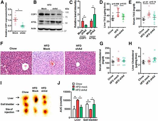 Figure 6. Knockdown of hepatic COP1 reduces hepatic lipid accumulation and improves liver function in HFD-fed mice. HFD-fed mice were injected with adenovirus carrying shRNA against murine COP1 (shAd, green) or with vehicle (mock, red). Relative mRNA expression (A) and protein levels (B) of COP1 and ATGL in livers of indicated mice. C: Relative quantification of the band intensity normalized with actin (n = 6). Data are expressed as mean ± SD relative to mock. Liver (D) and serum TAG (E) levels of chow-fed control (black), HFD (red), and shAd (green) mice. F: The H&E staining of liver sections from indicated mice. Scale bars, 100 μm. Cholesterol levels were assayed from serum (G) and liver tissue (H). Liver activity measured by analyzing 99mTc-mebrofenin signal 30 min after injection (n = 4) (I) and quantification of 99mTc-mebrofenin distribution in liver and gall bladder by calculating the area under the curve (AUC) at different time points for 30 min through 180 time frames, with data expressed as mean ± SD relative to chow (J). *P < 0.05, **P < 0.01 compared with chow or mock.