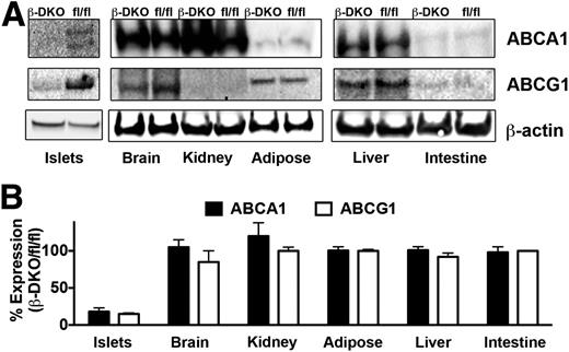 Figure 1. Conditional deletion of ABCA1 and ABCG1 in β-DKO mice. A: Tissue homogenates from β-DKO and Abca1fl/flAbcg1fl/fl mice were subjected to SDS-PAGE and immunoblotted for ABCA1, ABCG1, and β-actin. B: Quantification of blots from A. Results represent the mean ± SD of three independent experiments.