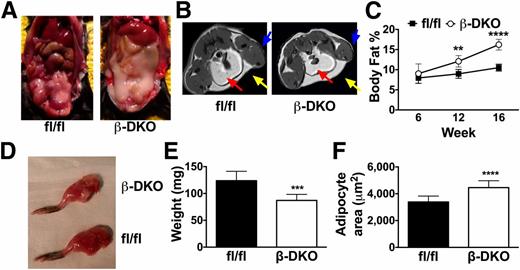 Figure 3. Adipose tissue mass is increased and skeletal muscle mass is decreased in β-DKO mice. A: Representative images of visceral fat in 16-week-old Abca1fl/flAbcg1fl/fl mice and β-DKO mice. B: Representative transverse section of MRI displays the differences in visceral (red arrow) and subcutaneous (yellow arrow) adipose tissue and hind limb muscle (blue arrow) size in 16-week-old Abca1fl/flAbcg1fl/fl mice and β-DKO mice. C: Body fat percentage by EchoMRI in 6-, 12-, and 16-week-old Abca1fl/flAbcg1fl/fl mice and β-DKO mice (n = 6/group). D: Representative image of skeletal muscle in dissected hind limb in 16-week-old β-DKO mice and Abca1fl/flAbcg1fl/fl mice. E: Weight of isolated gastrocnemius muscle in 16-week-old Abca1fl/flAbcg1fl/fl mice and β-DKO mice (n = 8/group). F: Quantification of adipocyte size in 16-week-old Abca1fl/flAbcg1fl/fl mice and β-DKO mice (n = 8/group, 10 sections/animal). Values represent mean ± SD. ***P < 0.005; ****P < 0.001.
