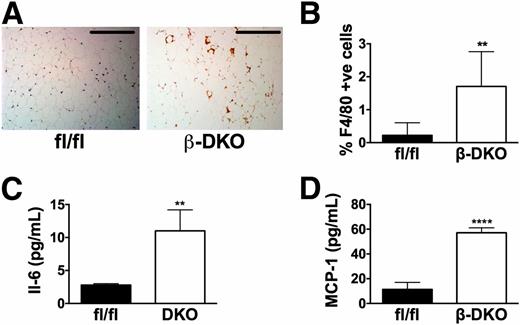 Figure 4. β-DKO mice have increased adipose tissue macrophage content and systemic inflammation. A: Representative histology of F4/80+ staining in adipose tissue from Abca1fl/flAbcg1fl/fl mice and β-DKO mice. Scale bars = 200 µm. B: Quantification of F4/80 staining from A (n = 8/group, 10 sections/animal). Plasma IL-6 (C) and MCP-1 (D) levels in 16-week-old Abca1fl/flAbcg1fl/fl mice and β-DKO mice (n = 6/group). Values represent mean ± SD. **P < 0.01; ****P < 0.001.