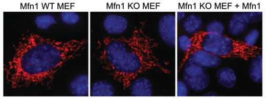 Mitochondrial morphology in wild-type (WT) and Mfn1 knockout (Mfn1KO) mouse embryonic fibroblasts (MEFs), transfected with mitochondrially targeted Mito-DsRed fluorescent protein and with Myc-tagged Mfn1 form.