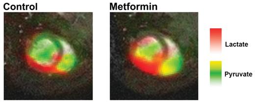 Hyperpolarized MRI demonstrates that almost the entirety of the lactate signal localizes to the left ventricular myocardium.