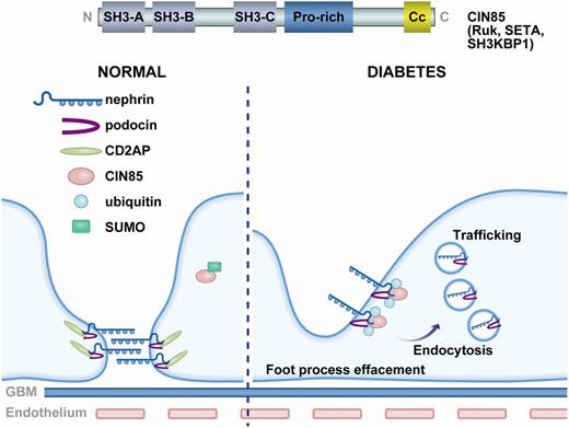 Figure 1. A schematic diagram of the domain structure of CIN85 and a proposed model of slit diaphragm turnover and trafficking of nephrin and podocin in diabetes. CIN85 contains three N-terminal SH3 domains, a centrally located proline-rich motif, and a COOH-terminal coiled-coil domain. In a normal condition, the slit diaphragm complexes, including CD2AP, nephrin, and podocin, are stabilized. The expression of CIN85 is low and SUMOylated. In a diabetic condition, the expression of CD2AP is decreased. CIN85 is upregulated and released from SUMO. CIN85 can bind to both nephrin and podocin and induce trafficking of both molecules. Cc, coiled-coil domain; GBM, glomerular basement membrane; Pro-rich, proline-rich motif.