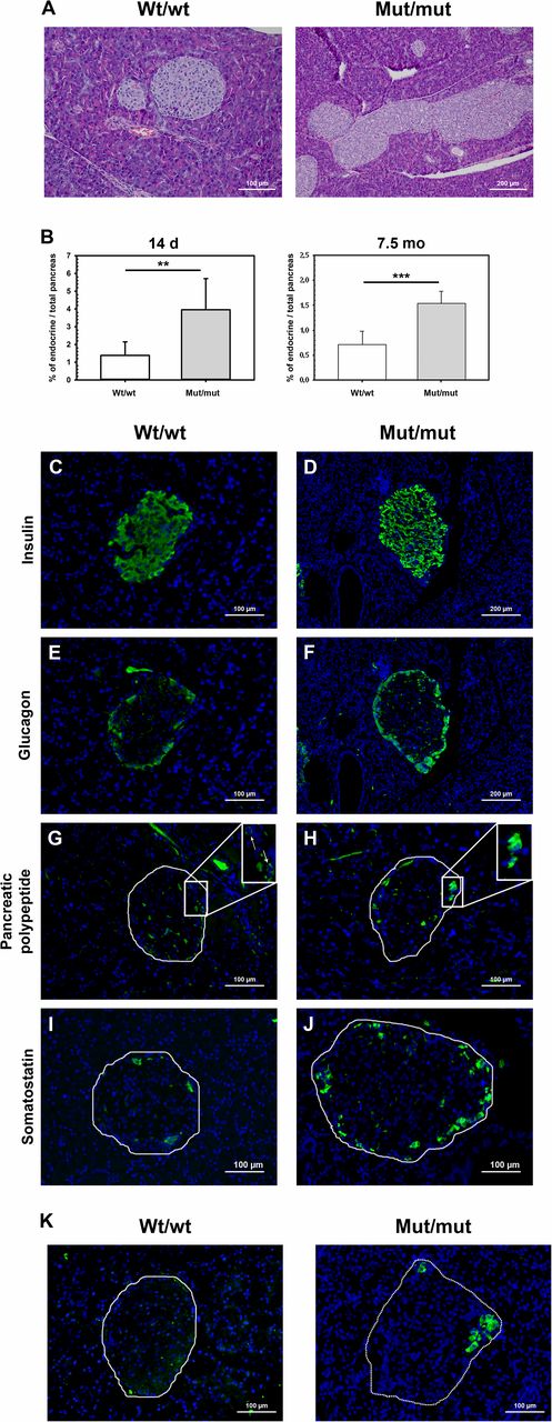 Figure 1. High ghrelin expression in normal and hyperplastic pancreatic islets in mut/mut rats. A: Hematoxylin-eosin–stained paraffin-embedded pancreas tissue from 7.5-month-old wt/wt and mut/mut rats. B: Quantification of the pancreatic islet area of 14-day-old and 7.5-month-old rats. The mut/mut rats showed a significant increase in pancreatic endocrine tissue compared with age-matched wt/wt rats at both time points. Values represent the mean ± SEM from 8 rats in each group. d, day; mo, month. **P ≤ 0.01; ***P ≤ 0.001. C–J: Immunofluorescent staining of paraffin-embedded pancreas tissue from 7.5-month-old wt/wt (C, E, G, and I) and mut/mut (D, F, H, and J) rats. Antibodies against insulin (C and D), glucagon (E and F), PP (G and H), and somatostatin (I and J) were used. G and H: The insets in G and H show an enlarged view of single PP-positive cells (white arrows) in the endocrine pancreas. K: Immunofluorescent staining of paraffin-embedded pancreas tissue from 7.5-month-old rats using an antibody against ghrelin revealed higher ghrelin expression in pancreatic islets of the mut/mut rats vs. the wt/wt rats. G–K: The circled area indicates one pancreatic islet.