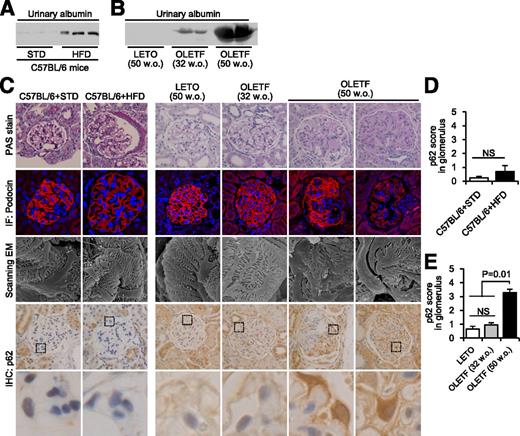 Figure 2. Autophagy insufficiency in podocytes of rodent diabetic models with massive proteinuria. Western blot analysis of urinary albumin in C57BL/6 mice fed an STD or HFD (A), and nondiabetic control LETO and diabetic OLETF rats at the indicated ages (weeks old [w.o.]) (B). C: Representative pictures of PAS, immunofluorescent (IF) assays of podocin, scanning electron microscopy (EM), and immunohistochemistry (IHC) for p62 in kidneys from C57BL/6 mice fed an STD or HFD, and LETO and OLETF rats at the indicated ages. Original magnifications: ×400 for PAS and IHC of p62, ×1,000 (mouse study) and ×600 (rat study) for IF of podocin, and ×8,000 for scanning EM. The black boxes indicate the areas for the magnified pictures. D and E: Semiquantitative measurement of p62 intensity in glomeruli in each rodent model. All results are presented as mean ± SEM and compared by ANOVA and a subsequent Tukey test, with P < 0.05 considered statistically significant. NS, no significance.