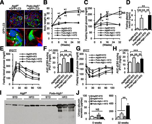 Figure 3. Exacerbation of HFD-induced proteinuria in podocyte-specific autophagy-deficient mice. A: GFP-LC3–positive dot analysis in podocytes of GFP-LC3 transgenic mice crossbred with either Atg5f/f or podocyte-specific Atg5 knockout (podo-Atg5−/−) mice fed ad libitum. Nidogen staining for visualization of basement membrane. White arrowheads indicate GFP-positive autophagosome dots. Original magnification ×1,000. The white boxes indicate the areas for the magnified pictures. B and C: Sequential changes in body weight and fasting blood glucose concentrations in the four groups of mice over the 32-week feeding period. D: Fasting insulin concentrations in the four groups of mice at the end of the experimental period. E and F: Glucose change and area under the curve (AUC) of glucose concentrations during intraperitoneal glucose tolerance tests (IPGTTs). G and H: Glucose change and AUC of glucose concentrations during intraperitoneal insulin tolerance tests (IPITTs). I: Western blot analysis of albumin in urine samples from the four groups of mice at the end of the experimental period. J: Urinary albumin excretion levels by ELISA at 0 and 32 weeks. All values are shown as mean ± SEM, with levels of significance determined by ANOVA and a subsequent Tukey test. *P < 0.05 vs. Atg5f/f mice fed STD; †P < 0.01 vs. Atg5−/− mice fed STD; **P < 0.01 and ***P < 0.05 vs. the indicated groups. BG, blood glucose; NS, no significance.