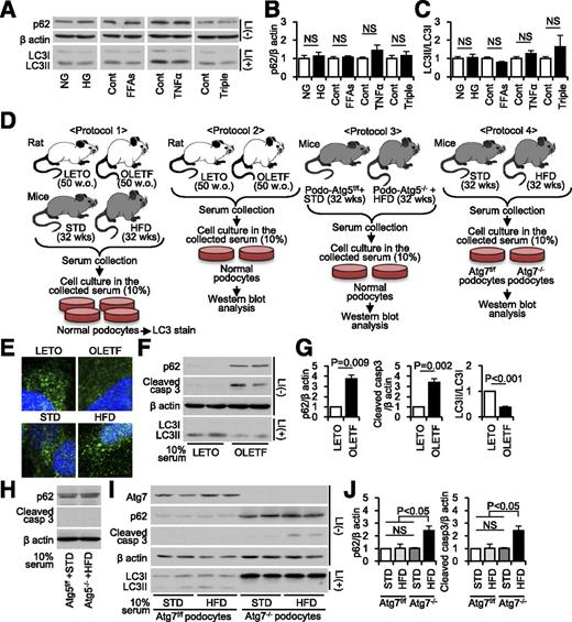 Figure 6. Autophagy insufficiency and apoptosis in cultured podocytes stimulated with serum from diabetic rodent models. A: Representative Western blots for p62, β-actin, and LC3 in cultured normal podocytes incubated with high glucose (500 mg/dL), fatty acids (palmitate and oleate, 150 μmol/L each), TNFα, or all three reagents (triple). Quantitative ratios of p62 to β-actin (B) and of LC3II to LC3I (C) (n = 3). D: Study protocols 1–4 for cell culture with sera from the indicated nondiabetic and diabetic rodents. E: Representative pictures of LC3 immunofluorescence in cultured normal podocytes incubated with 10% serum from the rodents indicated in protocol 1. F: Representative Western blots for p62, cleaved caspase 3, β-actin, and LC3 in cultured normal podocytes incubated with 10% serum of the rats indicated in protocol 2. G: Quantitative ratios of p62 and cleaved caspase 3 to β-actin, and ratio of LC3II to LC3I (n = 3). H: Representative Western blots for p62 and cleaved caspase 3 in cultured normal podocytes incubated with 10% serum of Atg5f/f mice fed an STD or Atg5-deficient mice fed an HFD indicated in protocol 3. I: Representative Western blots of Atg7, p62, cleaved caspase 3, β-actin, and LC3 in cultured Atg7f/f and Atg7-deficient podocytes incubated with 10% sera from the mice indicated in protocol 4. J: Quantitative ratios of p62 and cleaved caspase 3 to β-actin (n = 3). All values are presented as mean ± SEM. ANOVA and a subsequent Tukey test were used to determine significance in multiple comparisons, whereas Student t test was used for pairwise comparisons. P < 0.05 was considered statistically significant. Cont, control; FFA, free fatty acid; HG, high glucose; NG, normal glucose; NS, no significance; w.o., weeks old.