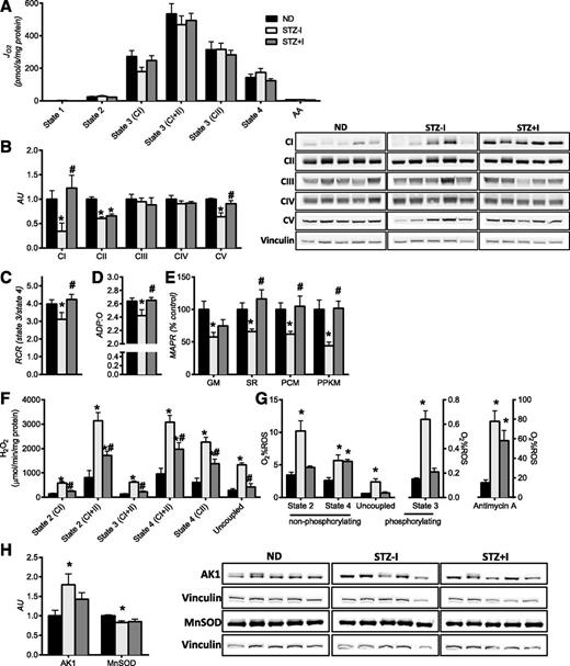 Figure 1. Insulin deprivation adversely affects skeletal muscle mitochondrial physiology. A: Oxygen consumption (JO2) was not different across groups. Expression of mitochondrial respiratory CI and V proteins (B) and mitochondrial coupling efficiency, measured by respiratory control ratios (RCR) (C) and ADP:O ratio (D), was reduced by insulin deprivation and corrected by insulin treatment. E: Mitochondrial ATP production rate (MAPR) was significantly lower with insulin deprivation and restored with insulin therapy. F: Mitochondrial H2O2 emissions were elevated with insulin deprivation and partially reduced by insulin replacement across all respiratory states. G: O2 consumption as a percent of ROS was higher in STZ–I. H: Increase in mitochondrial ROS production was associated with downregulation of mitochondrial MnSOD. Increased expression of AMP-sensitive adenylate kinase 1 (AK1) confirms the low-energy state of skeletal muscle in insulin-deprived animals. Substrate combinations description: GM, glutamate and malate; SR, succinate and rotenone; PCM, palmitoylcarnitine and malate; PPKM, palmitoylcarnitine, pyruvate, α-ketoglutarate, and malate. Data are means ± SEM (n = 13 per group for mitochondrial functional measurements, n = 6 for Western blot measurements). AA, amino acids; AU, arbitrary unit. *P < 0.05 vs. ND; #P < 0.05 vs. STZ–I group.