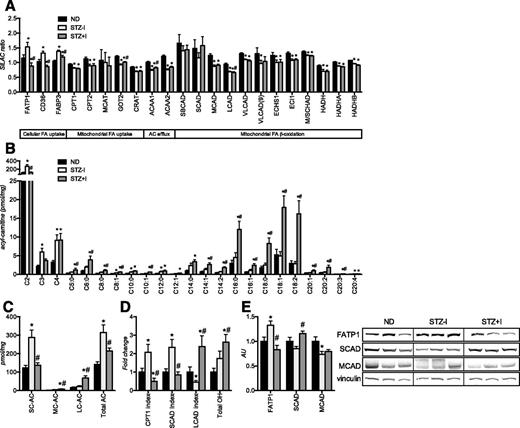 Figure 4. Both insulin deprivation and treatment leads to accumulation of acyl-carnitines and suggests incomplete fatty acid β-oxidation in skeletal muscle of T1D mice. Expression of FA intracellular transport and β-oxidation proteins is affected in insulin-deprived mice and not fully corrected by insulin replacement, as revealed by high-throughput proteomic analysis (A) and Western blot (E). Insulin deprivation increases skeletal muscle short-chain acyl-carnitine content (B and C) and elevates CPT1 and SCAD inhibition indexes (D). Insulin treatment corrects expression of proteins of intracellular FA uptake and short-chain FA β-oxidation (A) and reverses short-chain acyl-carnitine (SC-AC) accumulation and CPT1 and SCAD inhibition indexes (B and C) but leads to accumulation of medium-chain (MC-AC), long-chain (LC-AC), and 3-hydroxy (total OH) acyl-carnitine species (B and C) and increases the LCAD inhibition index (D). SC-AC, C2–C5 acyl-carnitines; MC-AC, C6–C12 acyl-carnitines; LC-AC, C14–C20 acyl-carnitines. Data are means ± SEM (n = 6 per group). AU, arbitrary unit; M/SCHAD, medium-/short-chain 3-hydroxyacyl-coenzyme A dehydrogenase. *P < 0.05 vs. ND; #P < 0.05 vs. STZ–I group.